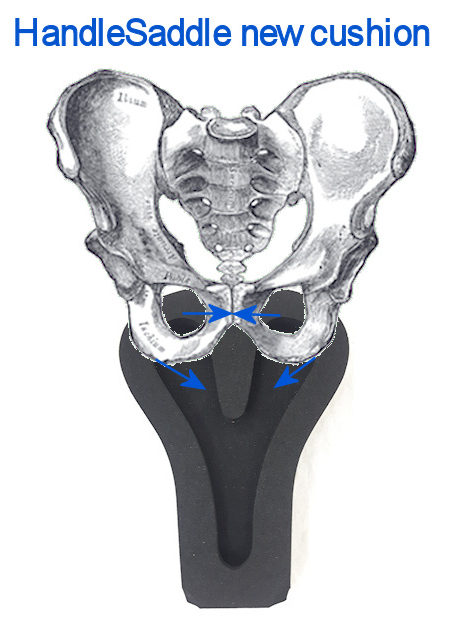 HandleSaddlePelvis.jpg