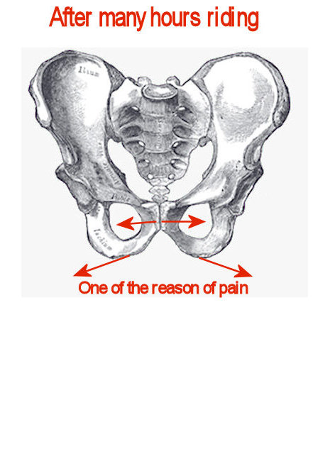 StandardSaddlePelvis.jpg